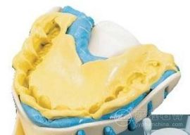 齿科印模材专用硫酸钙石膏粉
